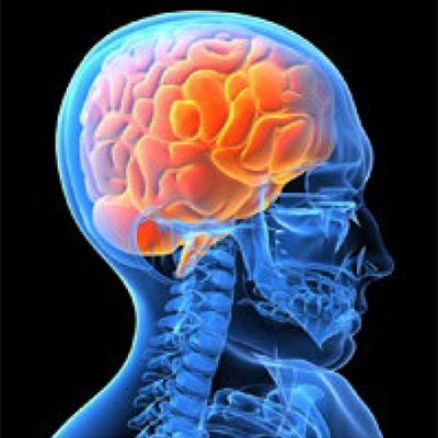 Post-Concussion Syndrome
